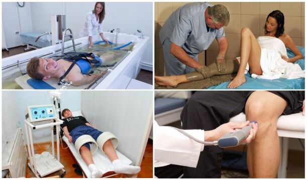 Procedimientos de fisioterapia para la osteoartritis de la articulación de la rodilla. 
