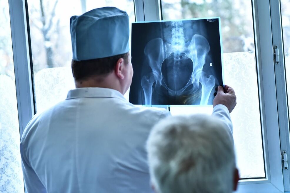 El médico examina la imagen de una articulación de cadera con artrosis.
